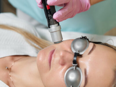 Лазерная косметология